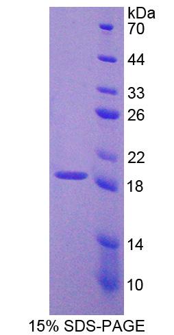 Recombinant Protocadherin 20 (PCDH20)