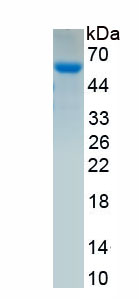 Recombinant Ephrin Type B Receptor 2 (EPHB2)