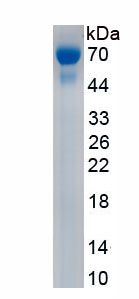 Recombinant Ephrin Type B Receptor 2 (EPHB2)