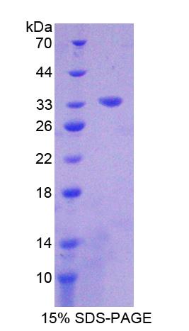 Recombinant Ephrin Type B Receptor 3 (EPHB3)