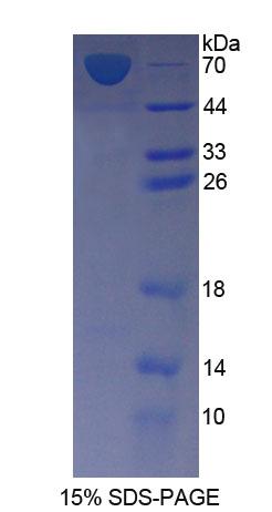 Recombinant Farnesyl Diphosphate Synthase (FDPS)