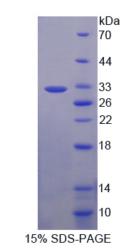 Recombinant Proprotein Convertase Subtilisin/Kexin Type 9 (PCSK9)