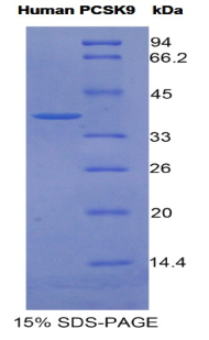 Recombinant Proprotein Convertase Subtilisin/Kexin Type 9 (PCSK9)
