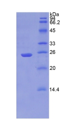 Recombinant Puromycin Sensitive Aminopeptidase (PSA)