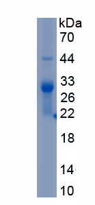 Recombinant Elastase 2A (ELA2A)