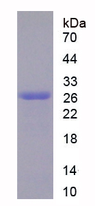 Recombinant Elastase 3B (ELA3B)