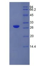 Recombinant Elastase 3B (ELA3B)