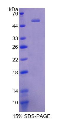 Recombinant Chymotrypsinogen B2 (CTRB2)