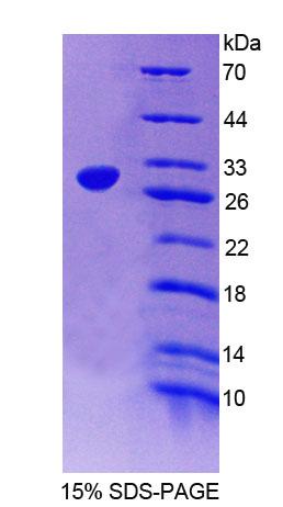 Recombinant Sarcoglycan Delta (SGCd)