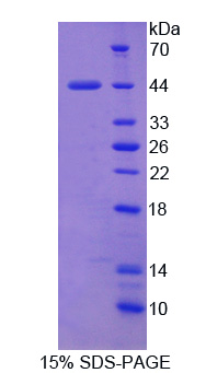 Recombinant Apoptosis Inhibitor 5 (API5)