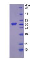 Recombinant Homogentisate-1,2-Dioxygenase (HGD)