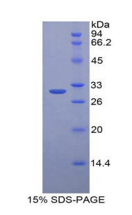 Recombinant Homogentisate-1,2-Dioxygenase (HGD)