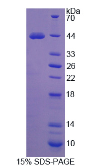 Recombinant Prolyl-4-Hydroxylase Alpha Polypeptide II (P4Ha2)