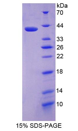 Recombinant Prolyl-4-Hydroxylase Alpha Polypeptide III (P4Ha3)