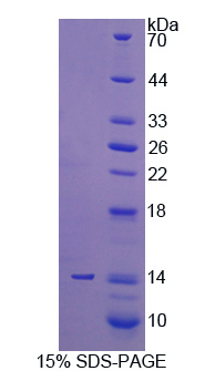 Recombinant Procollagen Lysine-2-Oxoglutarate-5-Dioxygenase 3 (PLOD3)