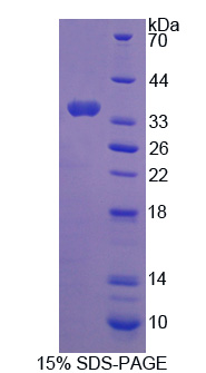 Recombinant C-Ros Oncogene 1, Receptor Tyrosine Kinase (ROS1)