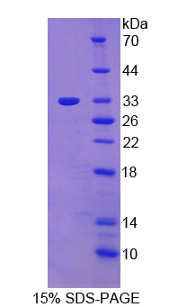 Recombinant Protein Tyrosine Kinase 6 (PTK6)