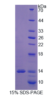 Recombinant Excitatory Amino Acid Transporter 3 (EAAT3)