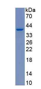Recombinant Excitatory Amino Acid Transporter 1 (EAAT1)
