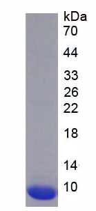 Recombinant Excitatory Amino Acid Transporter 2 (EAAT2)