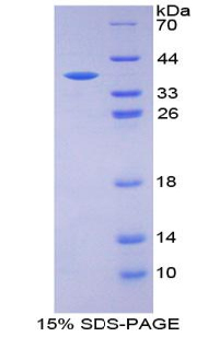 Recombinant Glucose Transporter 14 (GLUT14)