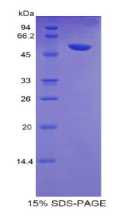 Recombinant Glucose Transporter 14 (GLUT14)