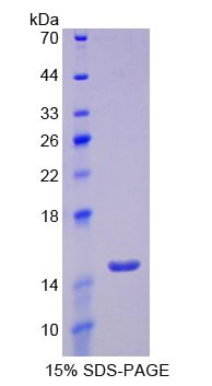 Recombinant Glucose Transporter 14 (GLUT14)