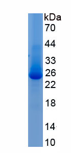 Recombinant Solute Carrier Family 7, Member 9 (SLC7A9)
