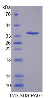 RPE459Hu01.jpg