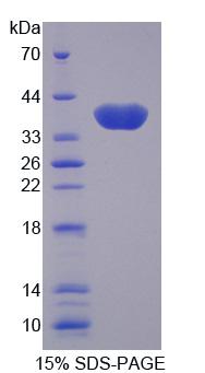 Recombinant Oxoglutarate Carrier Protein, Mitochondrial (OGC)