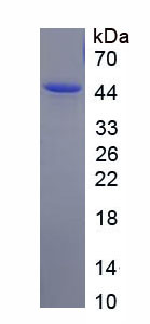 Recombinant Solute Carrier Family 39, Member 4 (SLC39A4)