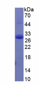 Recombinant Endothelial Cell Adhesion Molecule (ESAM)