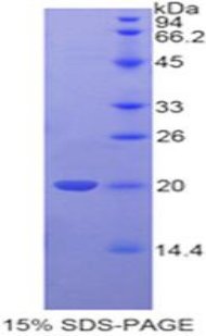 Recombinant Tafazzin (TAZ)