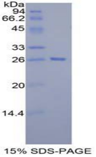 Recombinant Tafazzin (TAZ)