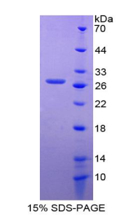 Recombinant Glycoprotein 2, Zymogen Granule Membrane (GP2)