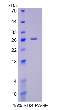 Recombinant Glycoprotein 2, Zymogen Granule Membrane (GP2)