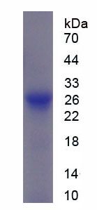 Recombinant Alpha-1-B-Glycoprotein (a1BG)
