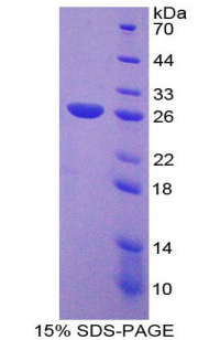 Recombinant Frizzled Homolog 1 (FZD1)