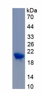 Recombinant Ubiquitin Conjugating Enzyme E2D1 (UBE2D1)