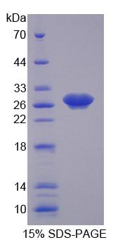 Recombinant Cyclin Dependent Kinase 16 (CDK16)
