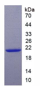 Recombinant Cyclin Dependent Kinase Inhibitor 1A (CDKN1A)