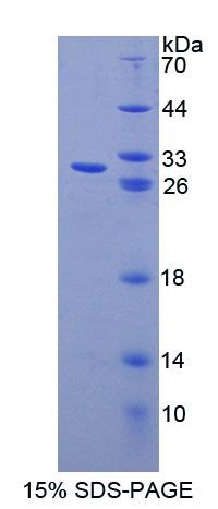 Recombinant Cyclin Dependent Kinase Inhibitor 1B (CDKN1B)