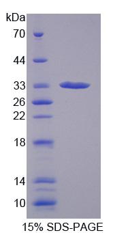 Recombinant Guanylate Binding Protein 1, Interferon Inducible (GBP1)