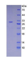 Recombinant Receptor Interacting Serine Threonine Kinase 3 (RIPK3)