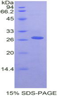 Recombinant Receptor Interacting Serine Threonine Kinase 3 (RIPK3)