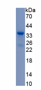 Recombinant Receptor Interacting Serine Threonine Kinase 1 (RIPK1)