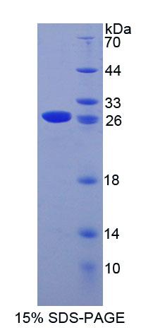 Recombinant Minichromosome Maintenance Deficient 3 (MCM3)