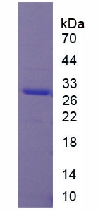 Recombinant Cell Division Cycle Protein 20 (CDC20)