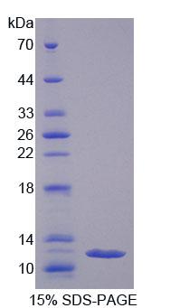 RPE676Hu02.jpg