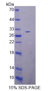 Recombinant Selenoprotein N1 (SEPN1)